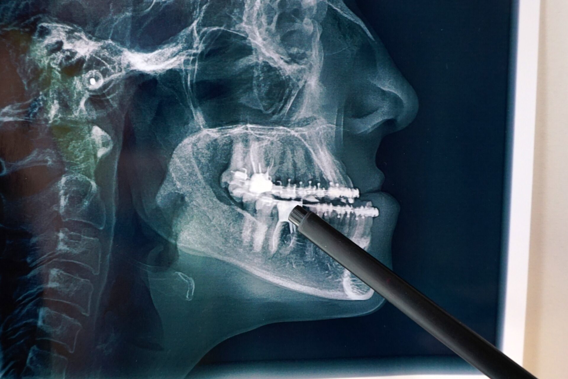 cirugia-maxilofacial